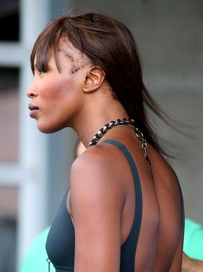 2010年頃には髪の毛ハゲが発覚したナオミキャンベル