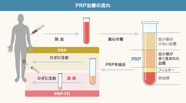 田中将大が代わりに受けたのが「PRP治療」だった