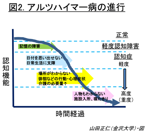 85歳相当のアルツハイマー病患者の脳に酷似していると診断されたクリス・ベノワの遺体