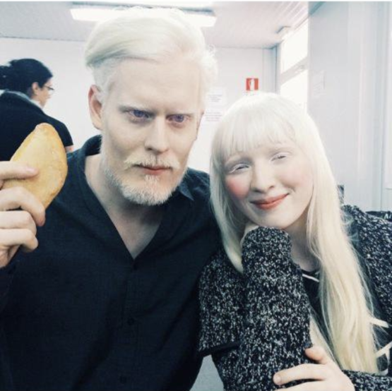 同じくアルビノのスティーブン・トンプソンとの2ショット